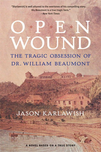 Cover of Open Wound - The Tragic Obsession of Dr. William Beaumont